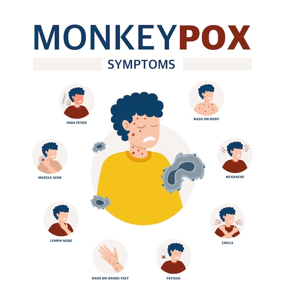 전염병과 질병의 확산에 대해 알리는 원숭이 수두 바이러스 포스터 사람의 이미지