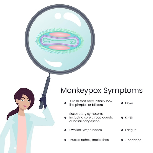 Monkeypox symptoms science vector diagram