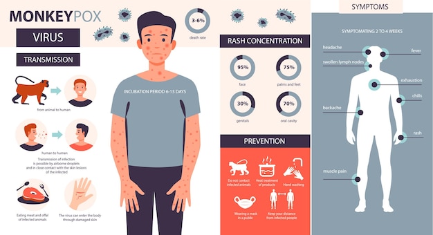 Monkeypox virus infographic Infection symptoms prevention of the disease of monkey pox