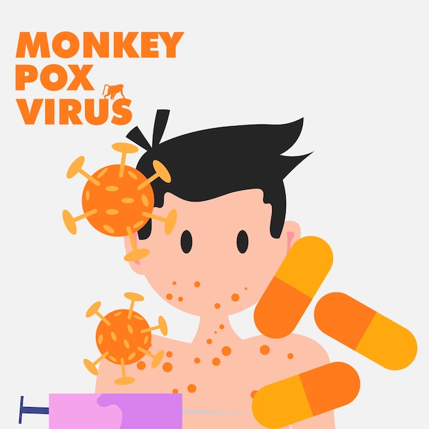 Monkeypox virus ontwerp banner vector