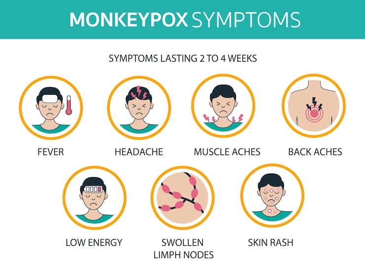 Vector monkeypox virus outbreak symptoms infographics world health organization fever headache aches rash infected people spreading from monkey flat design with icons