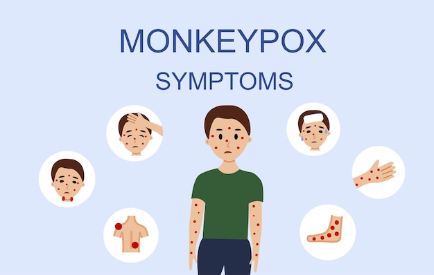 Monkeypox virus symptomen illustratie met mannelijk karakter monkeypox uitbraak concept door world health