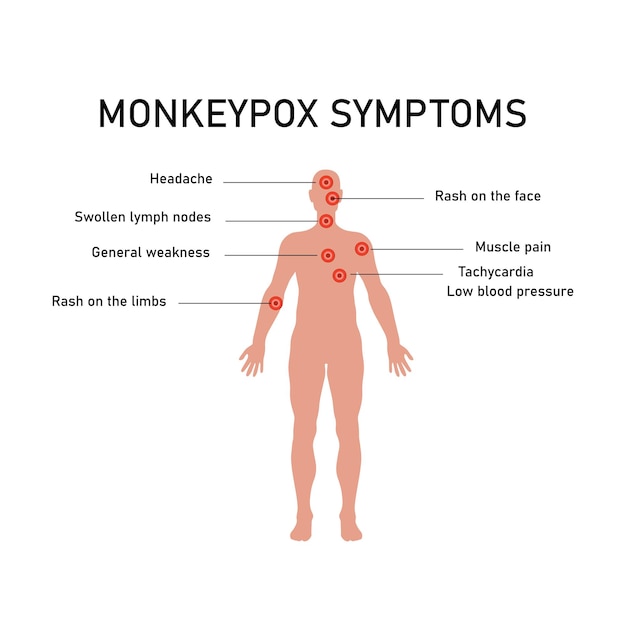 Monkeypox virus zoonotic viral disease that can infect human nonhuman primates Monkey pox Vector