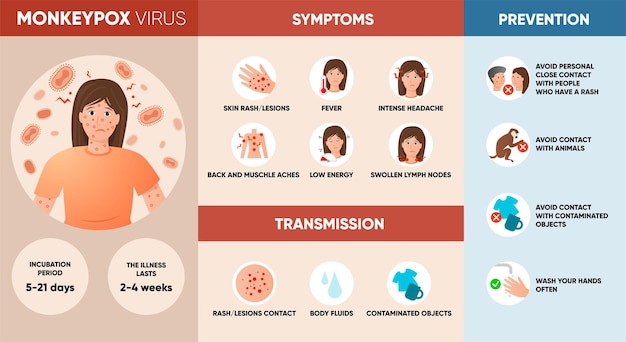 Monkeypox-virussymptomen, transmissie en preventie infographic poster.