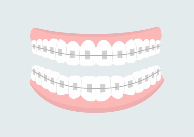 Vector mouth with teeth concept oral hygiene and cleanliness stomatology mouth with braces diagnosis and