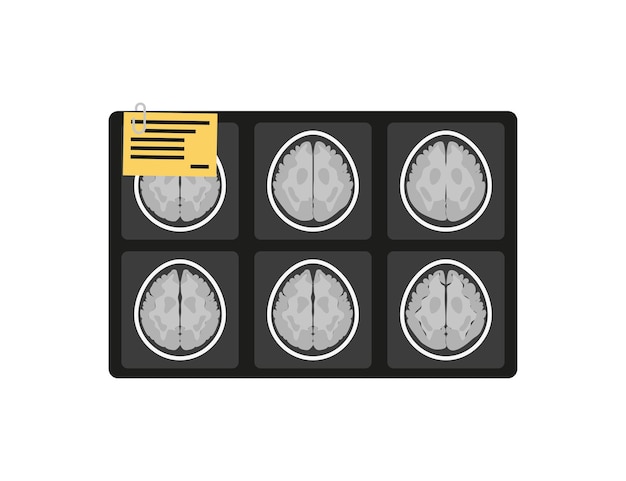 Vector mri xray brain picture in flat style vector