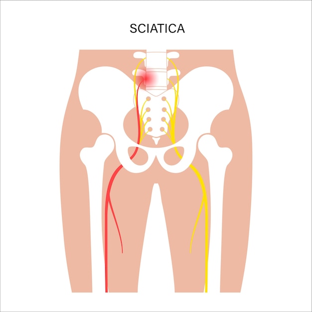 Muscular pelvis