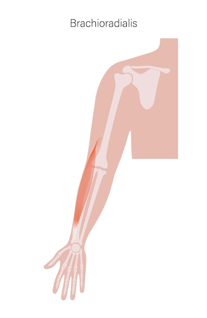 Vector muscular system arms