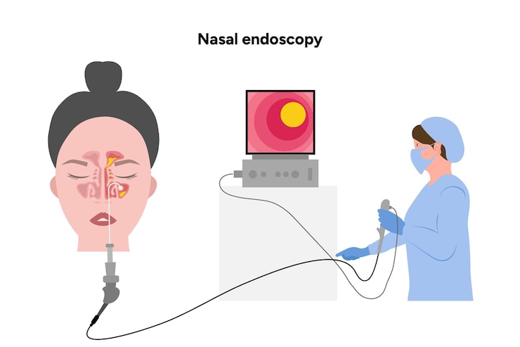 Vector nasal endoscopy procedure nasal and sinus passages with doctor otolaryng tube with camera light