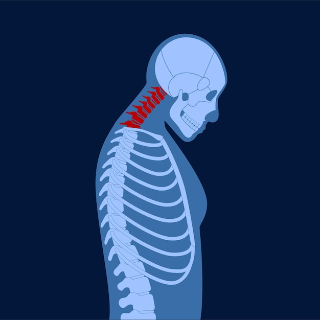 neck vertebrae deformity