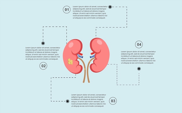 nierziekte, slechte gezondheid. interne menselijke orgel infographic sjabloon met vier opties.