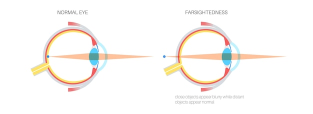 Vector normaal oog en verzicht