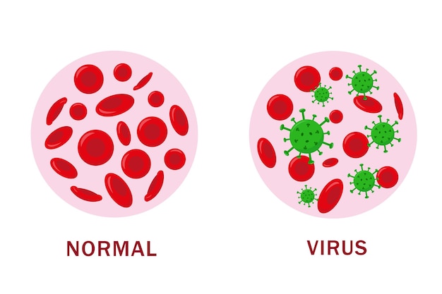 正常な血液と医療概念のためのウイルスを含む血液血液分析またはウイルス検査