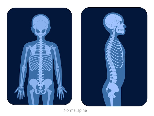 소년 몸의 정상적인 척추. 엑스레이 평면 벡터 일러스트 레이 션. 어린이 실루엣의 척추 관절과 골격 해부학. 정형 외과 포스터입니다. 클리닉과 병원을 위한 의료 배너입니다. 척추 통증 센터에서 검사.