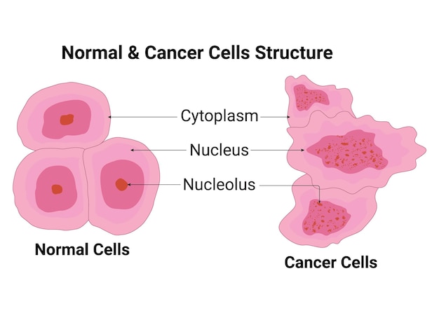 Normale en kankercellen structuur vectorillustratie