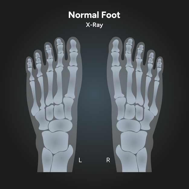Normale voet bij röntgenfoto