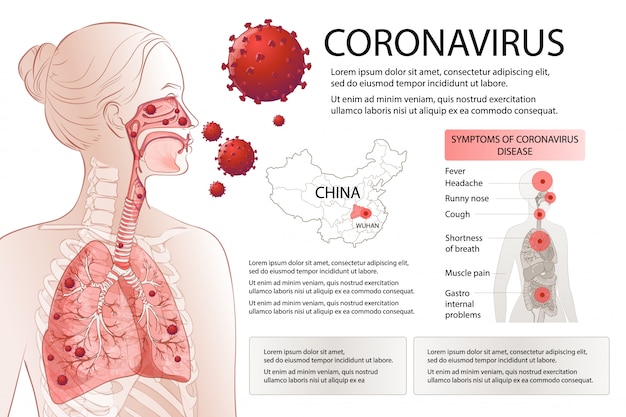 新規コロナウイルス（2019-ncov）停止。ヒトmers-cov症状の危険因子。ウイルスの大流行がパンデミックに広がりました。健康と医療検査、スクリーニング。呼吸、呼吸。ベクトル図のインフォグラフィック