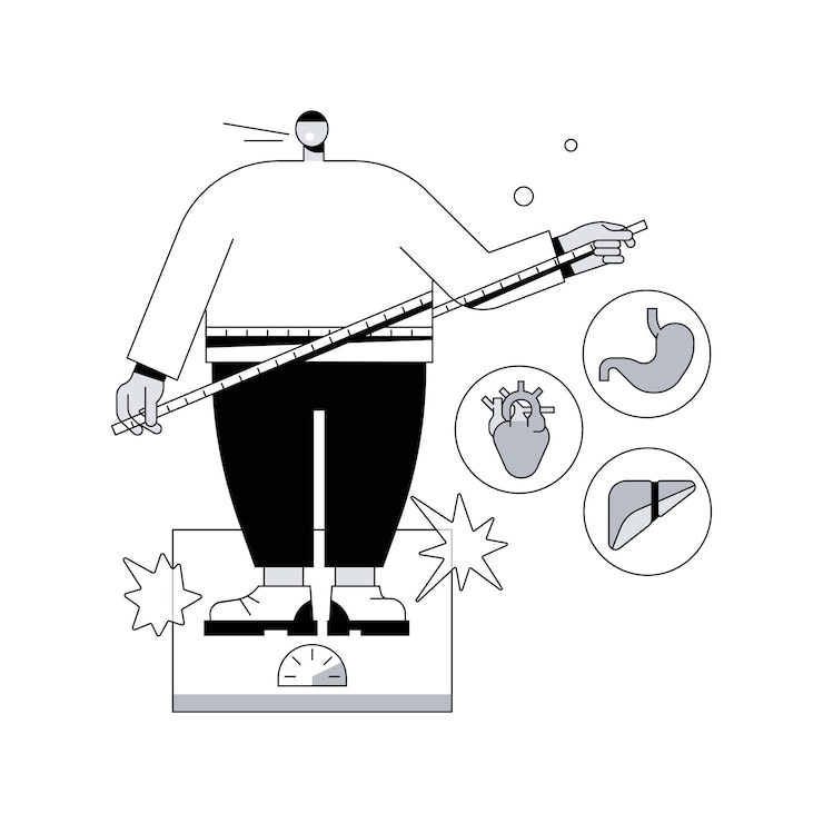 Vector obesity health problem abstract concept vector illustration