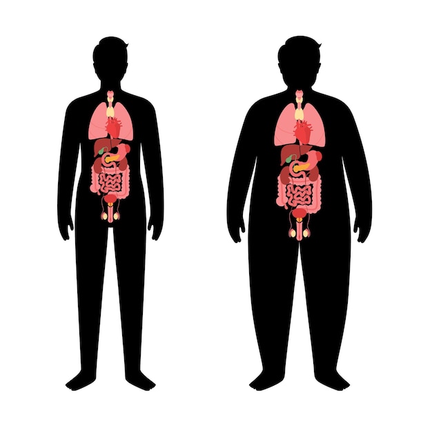 Organen in zwaarlijvig menselijk lichaam