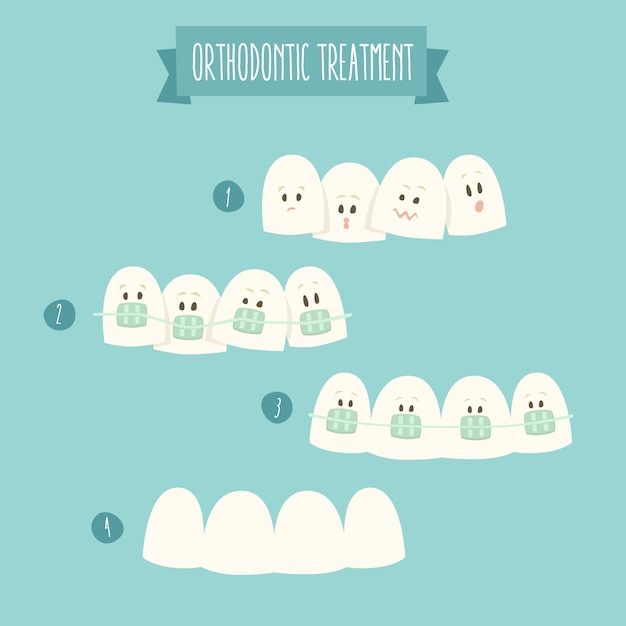 Orthodontic treatment (tooth braces) vector illustration