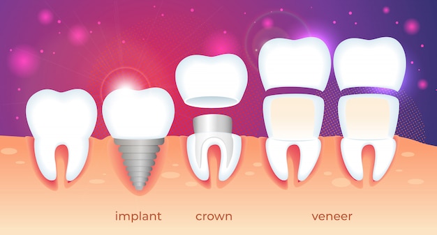 Orthodontische restauratie