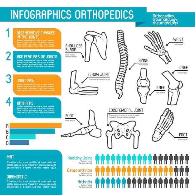 Orthopedie geneeskunde statistiek infographic ontwerp