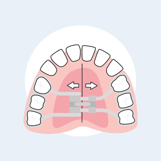 Vettore ortodoncia interceptiva ortodontista illustratrice vettoriale