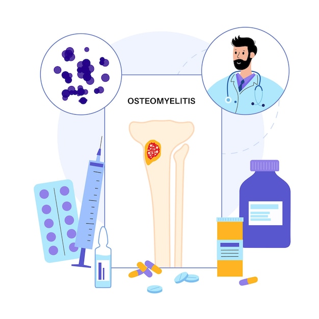 Osteomyelitis disease Infected leg bones sequestrum redness and pain Infection spreads through the bloodstream into the tibia bone Consultation with doctor in clinic medical vector illustration