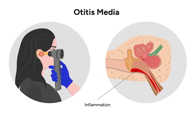 otitis media inflammation anatomy human ear pain disease medical infographic and check up in doctor