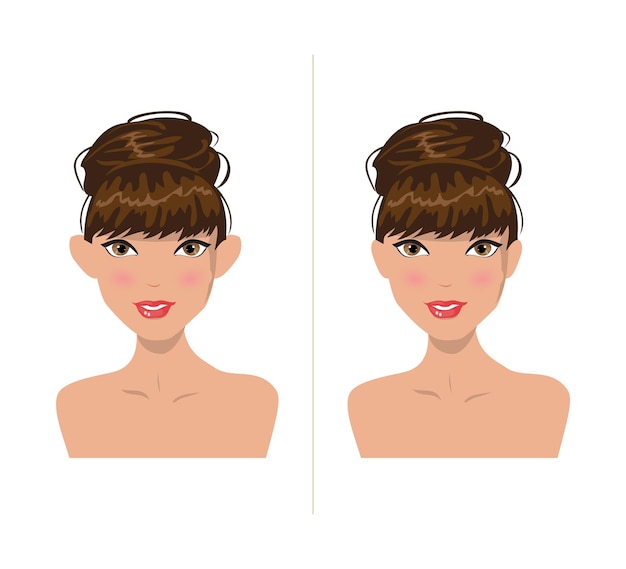 Vector otoplasty vector illustration