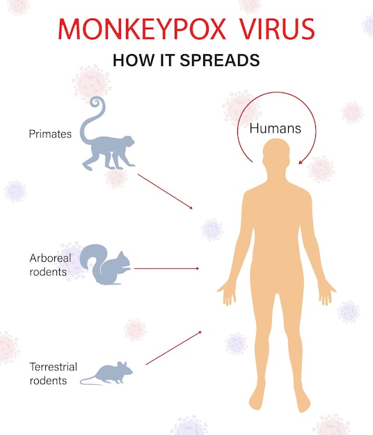 Overdracht van het apenpokkenvirus. de verspreiding van de epidemie. een uitbraak van een virale epidemie.