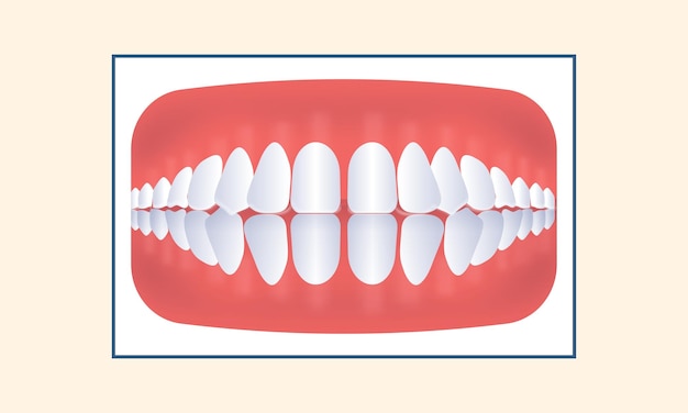 Overmatige afstand tussen tanden pictogram op gele achtergrond