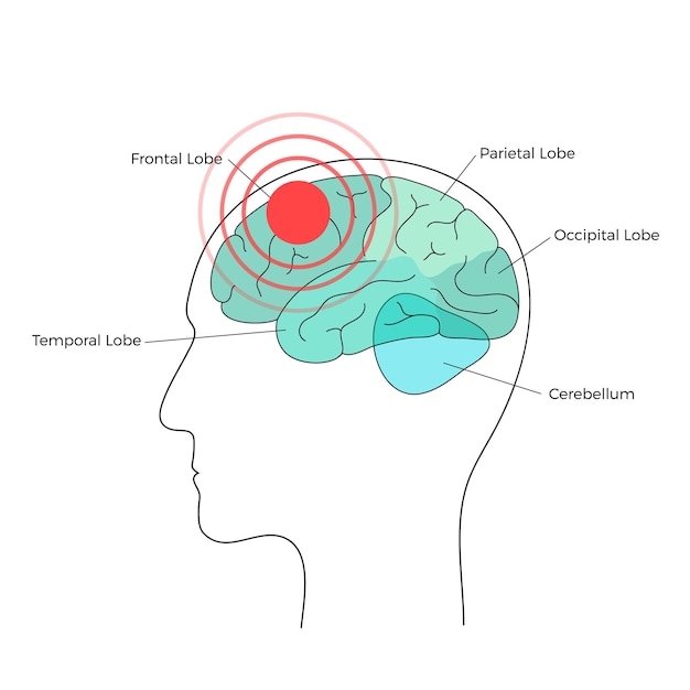 Illustrazione del cervello del dolore