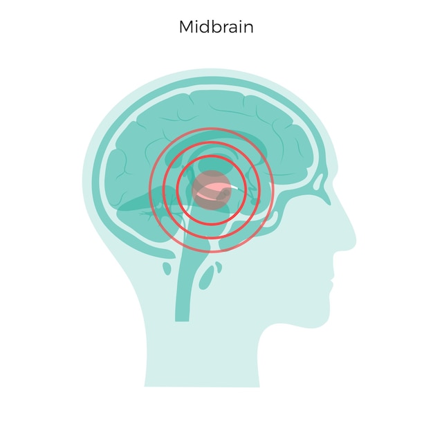 Vector pain brain illustration