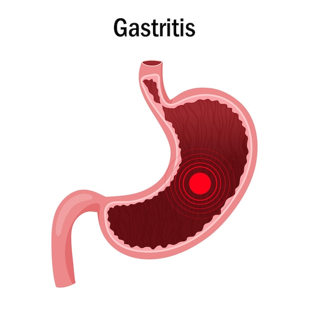 Pain or disease focus in stomach illustration