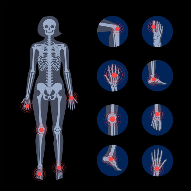 Pain in human body. female skeleton silhouette.