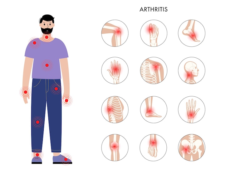 Pain in human body. Man silhouette. Spine, knee hip and other joint icons. Arthritis