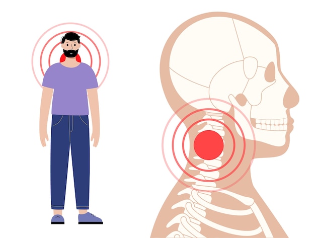 Вектор Боль в костях шеи или позвоночника. скелет рентгеновский силуэт медицинский плакат. суставы и хрящи