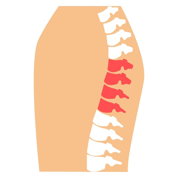Вектор Боль в грудных позвонках воспаленное запястье ревматизм артрит травма спины
