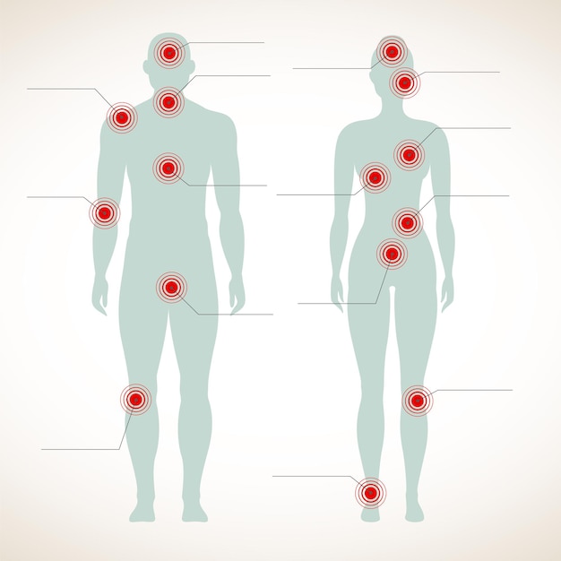 Pain infographic with human silhouettes of man and woman