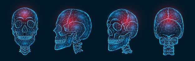 Vettore dolore, lesione o infiammazione dell'illustrazione poligonale delle ossa del cranio. modello low poly di un teschio umano