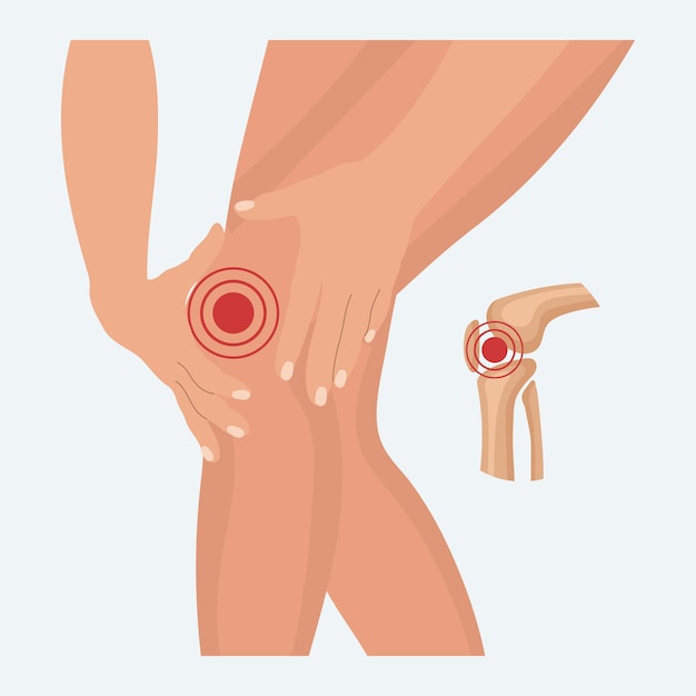 Vector pain in the knee joint knee arthritis leg pain due to rheumatoid arthritis anatomy of human bones