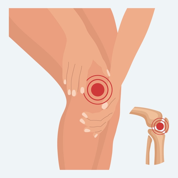 Боль в коленном суставе, артрит колена, боль в ноге при ревматоидном артрите Анатомия костей человека