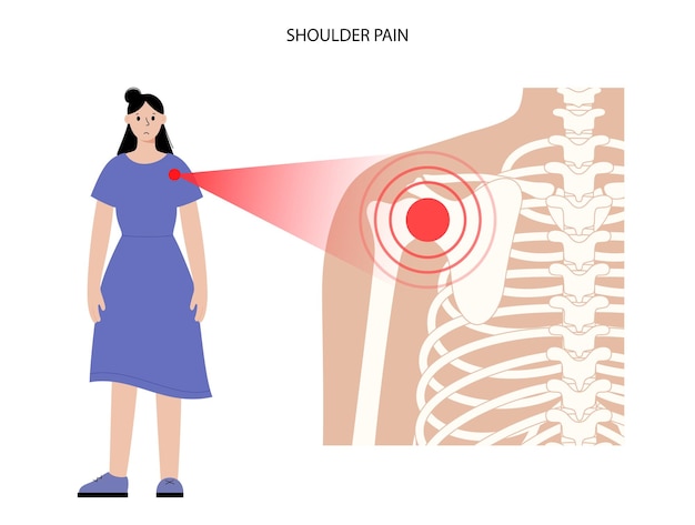 Dolore alla spalla o alla scapola. sagoma di donna scheletro raggi x. articolazioni e cartilagine. artrite