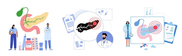 Vettore anatomia del pancreas illustrazione vettoriale piatta dell'apparato digerente e della clinica gastrointestinale