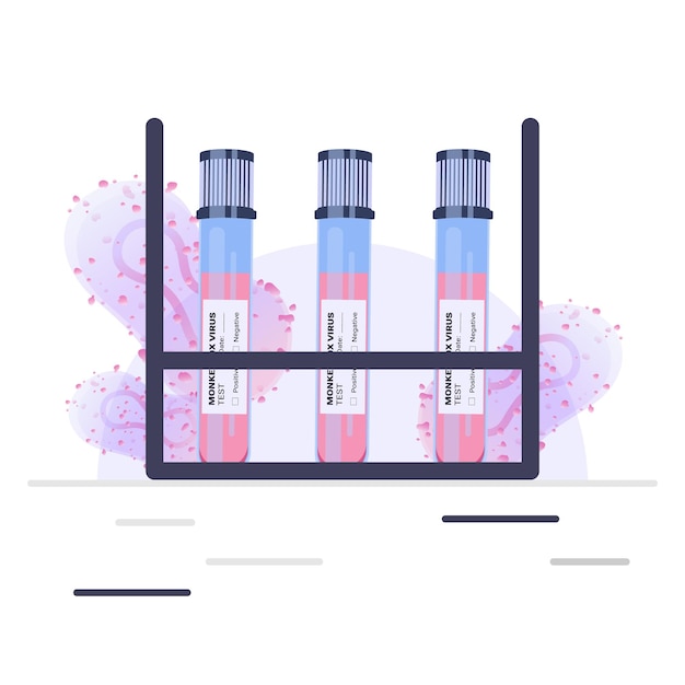 Vector pandemic monkeypox outbreak. blood sample tube for monkeypox virus test in the laboratory.