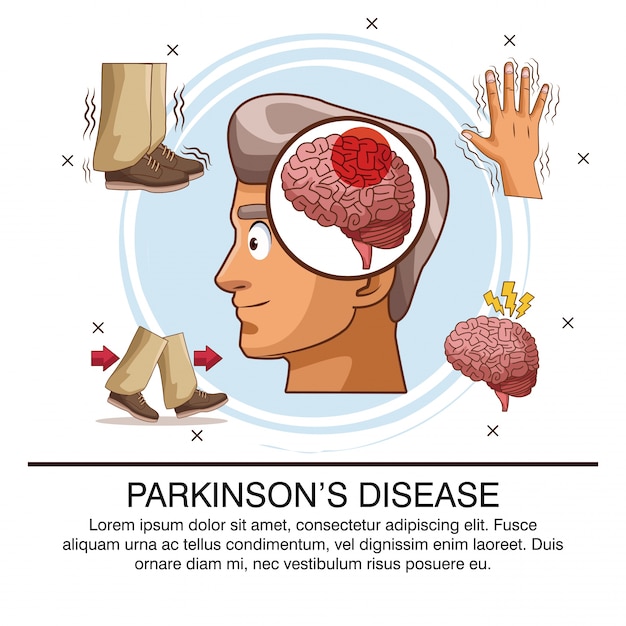 Parkinsons disease infographic