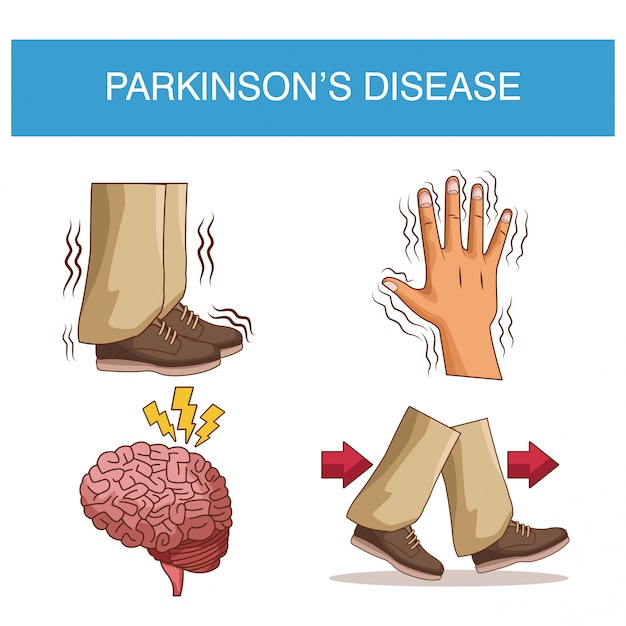 Infestazione da malattia di parkinson