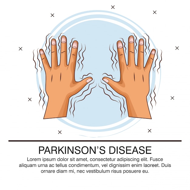 Infestazione da malattia di parkinson