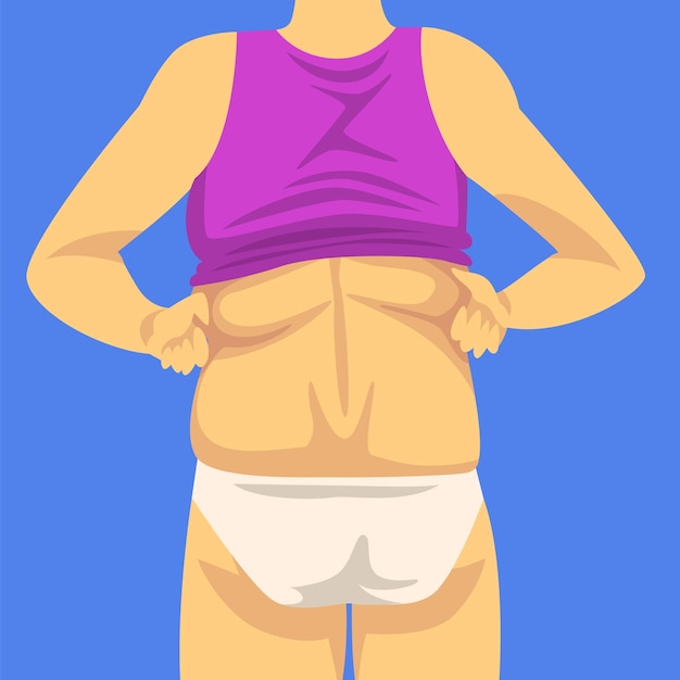 Vettore parte del corpo femminile figura umana dopo la perdita di peso retro vista obesità e problemi alimentari malsani illustrazione vettoriale stile piatto